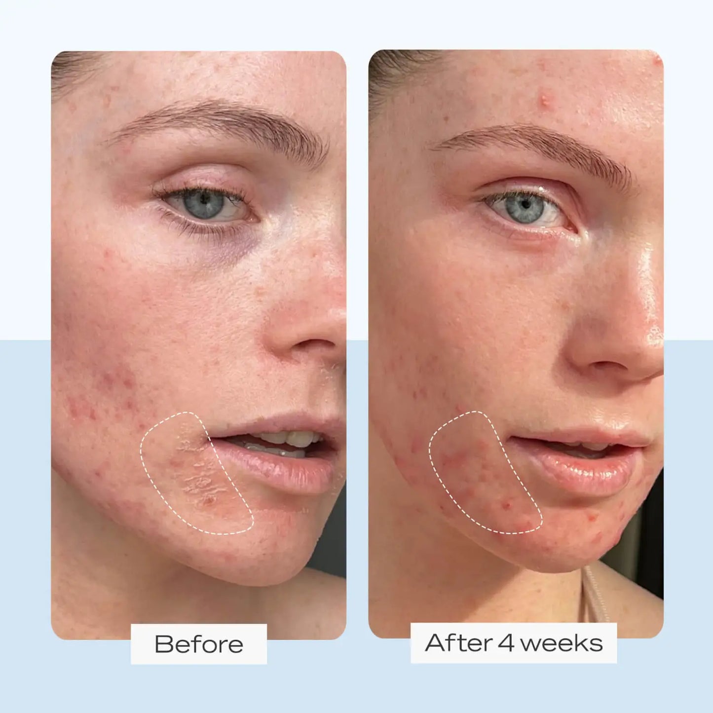 FIRST AID BEAUTY Ultra Krem Riparues 56.7g
