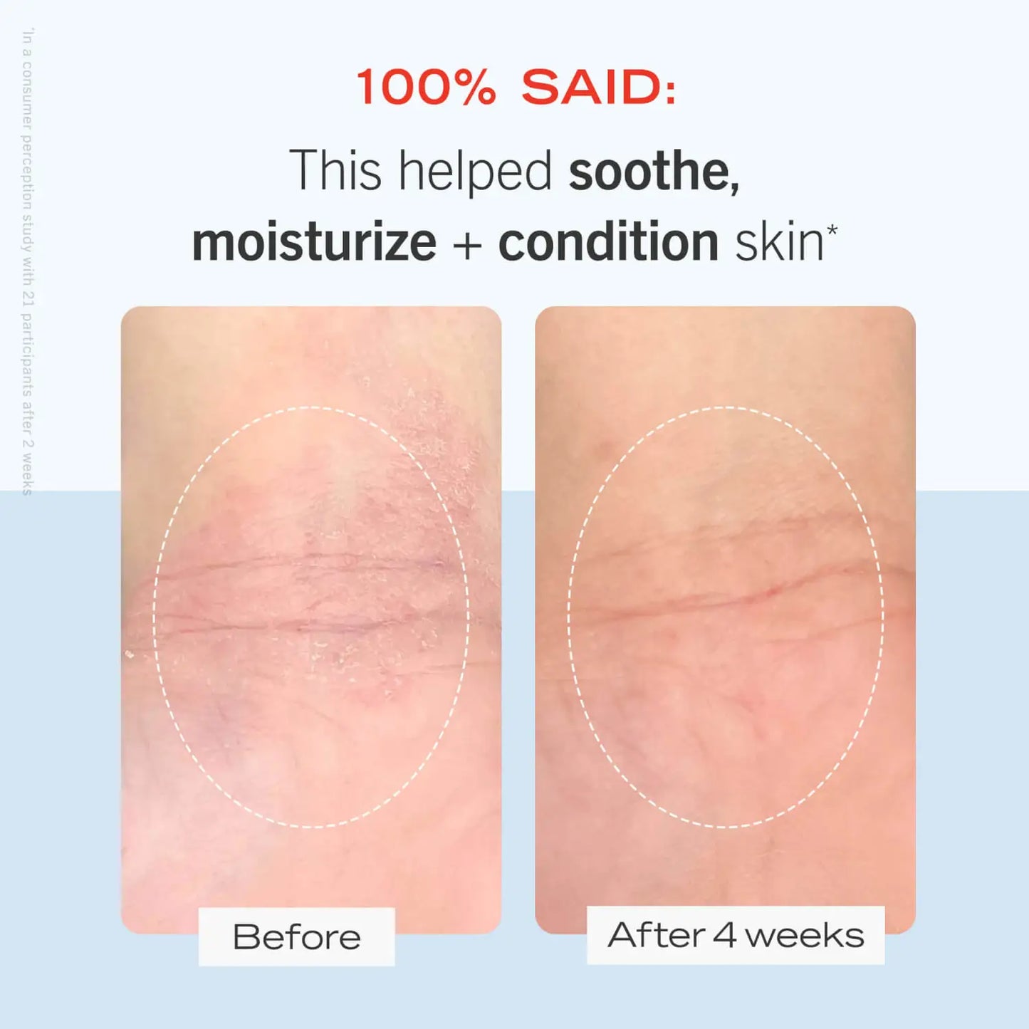 FIRST AID BEAUTY Ultra Krem Riparues 56.7g