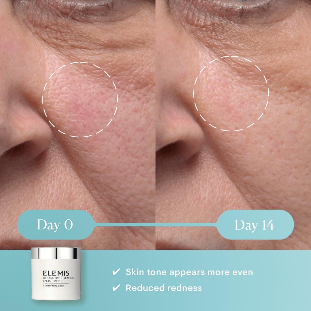 ELEMIS Dynamic Resurfacing Facial Pads - 14 copë