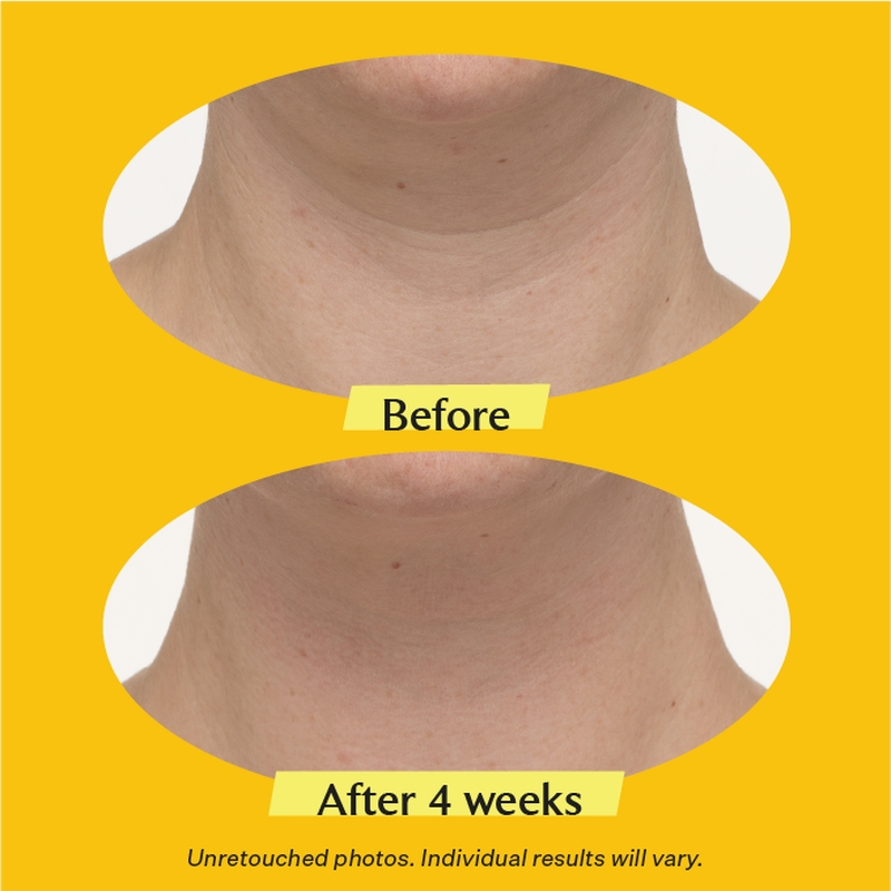Krem shtrëngues i qafës STRIVECTIN TL Advanced™ PLUS 30 ml