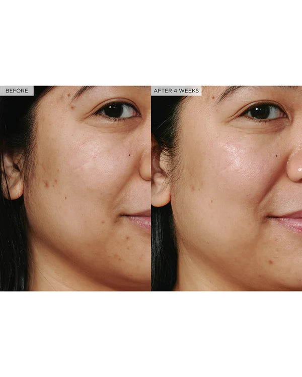 RECETA GLOW Pika e vesës me Shkëlqim shalqini Niacinamide