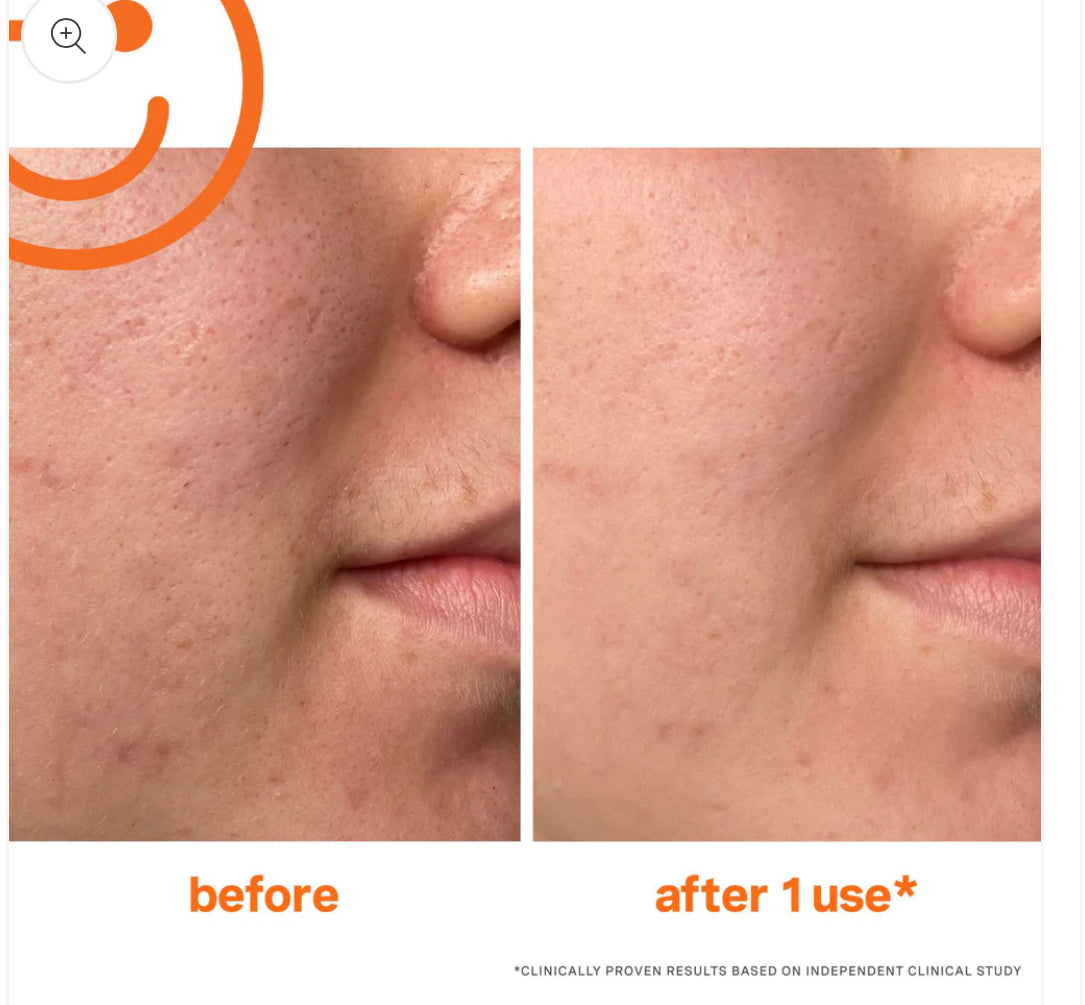 KATE SOMERVILLE ExfoliKate Trajtim Eksfoliues Intensiv 60ml