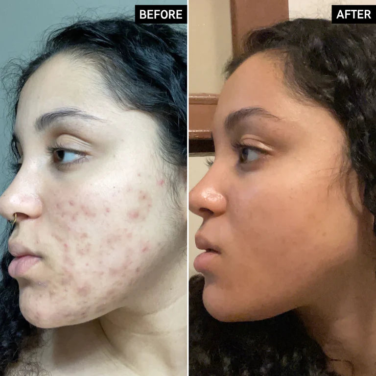 LISTA E BJESËVE Serum vitaminë C 30 ml