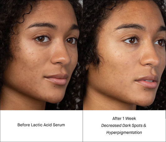 SHANI DARDEN Lactic Acid Serum 5 ml