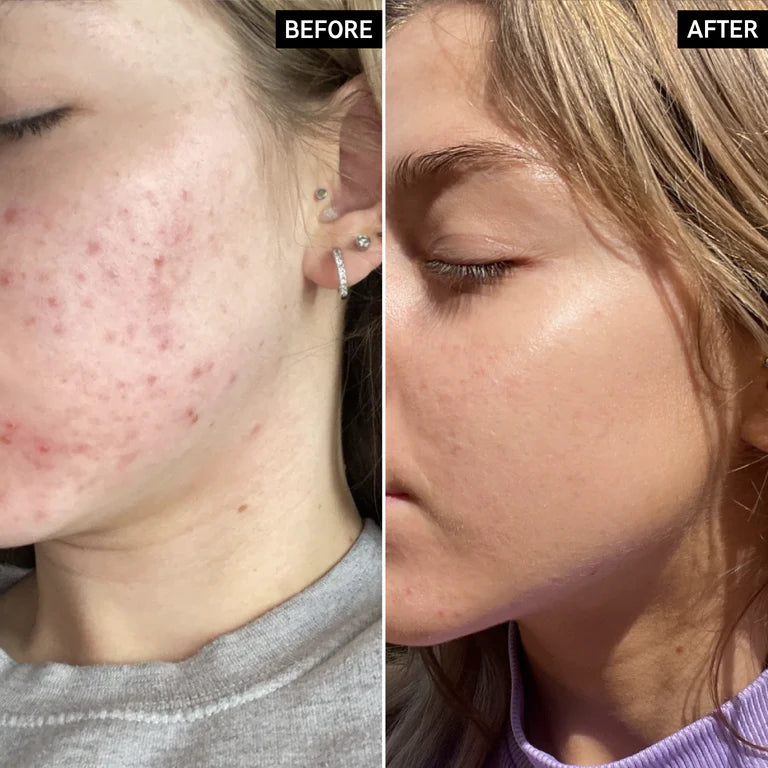 LISTA E BJAJËVE Serum Niacinamide 30 ml