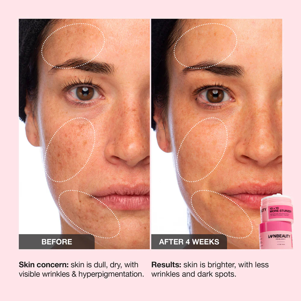 INNBEAUTY Project 10+10 Daily Moisturizer