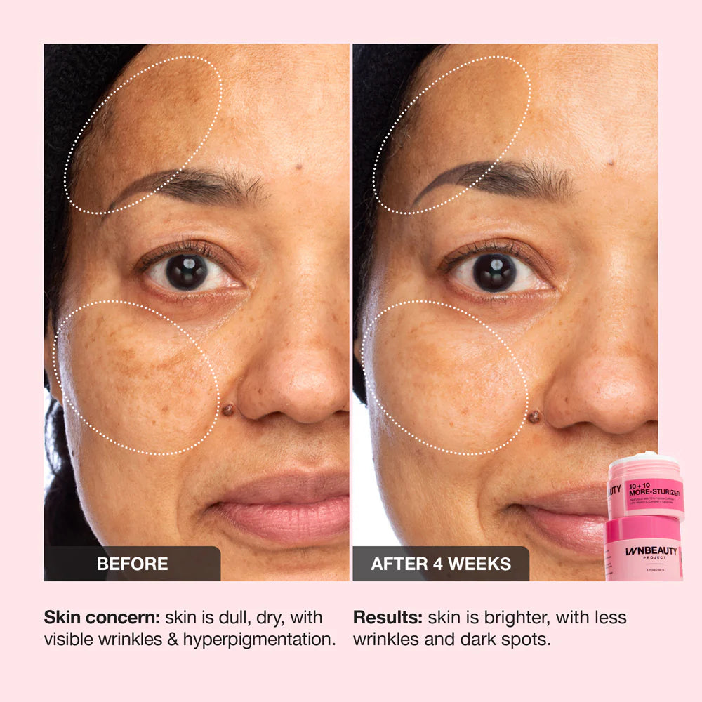 INNBEAUTY Project 10+10 Daily Moisturizer