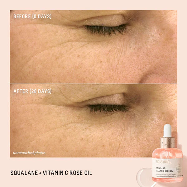 BIOSSANCE Squalane + Vitamina C vaj trëndafili