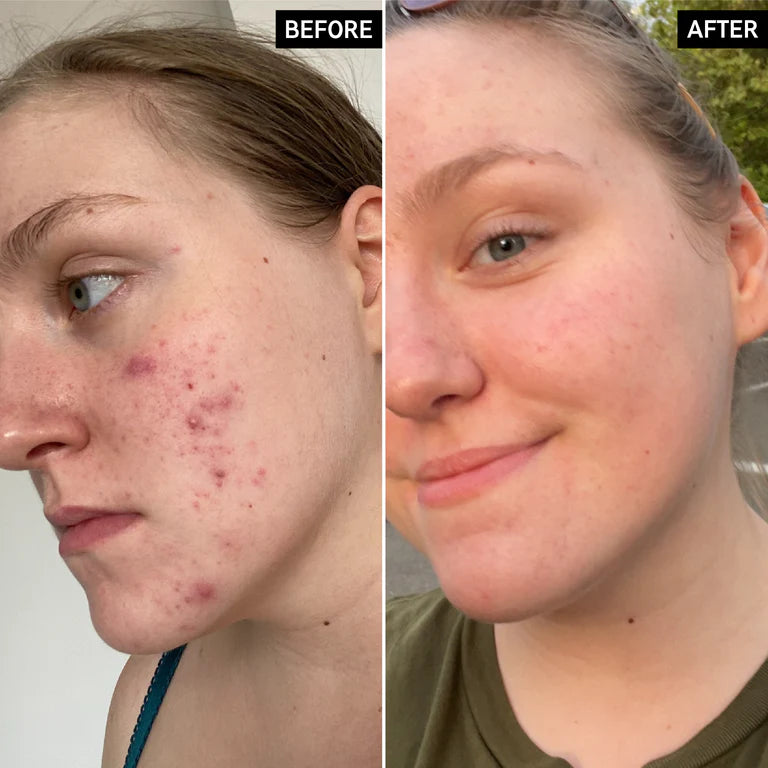 LISTA E Bojërave 15% Vitaminë C dhe Serum EGF 30ml
