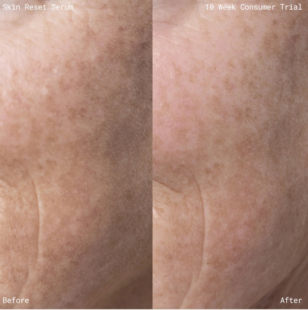 EMMA LEWISHAM Skin Reset Serum 10ml