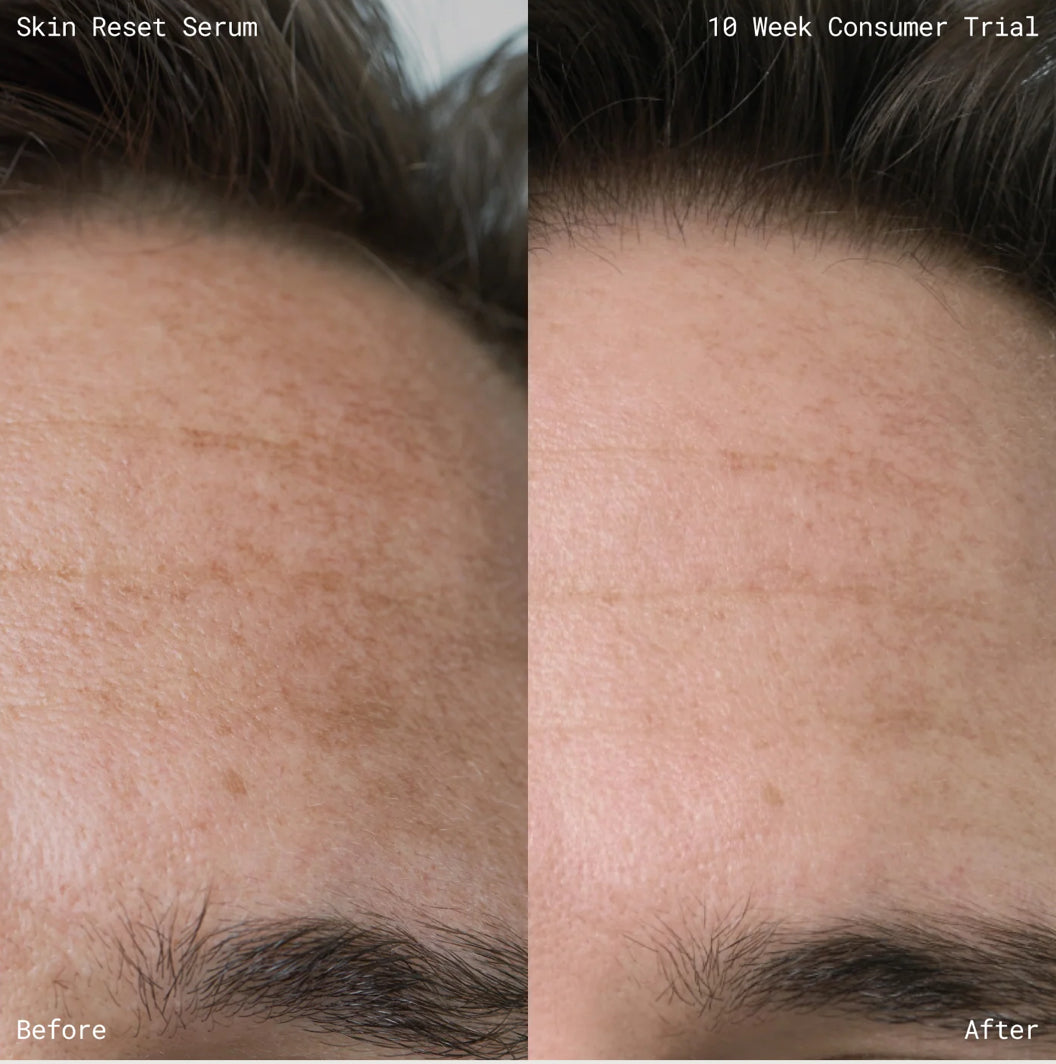 EMMA LEWISHAM Skin Reset Serum 10ml