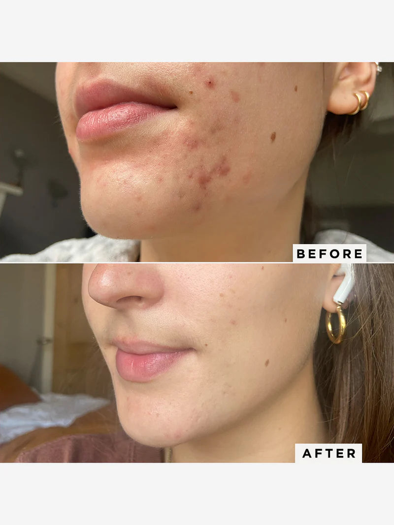 Dr Sam's Flawless Neutralising Gel