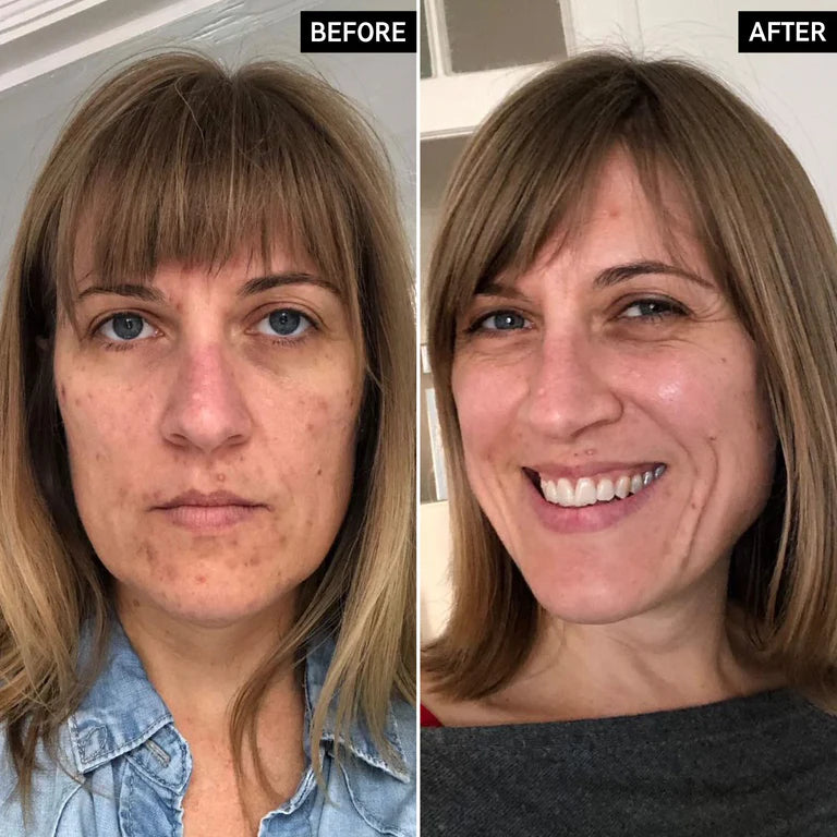 LISTA E BJENAVE Serum Retinol 30ml