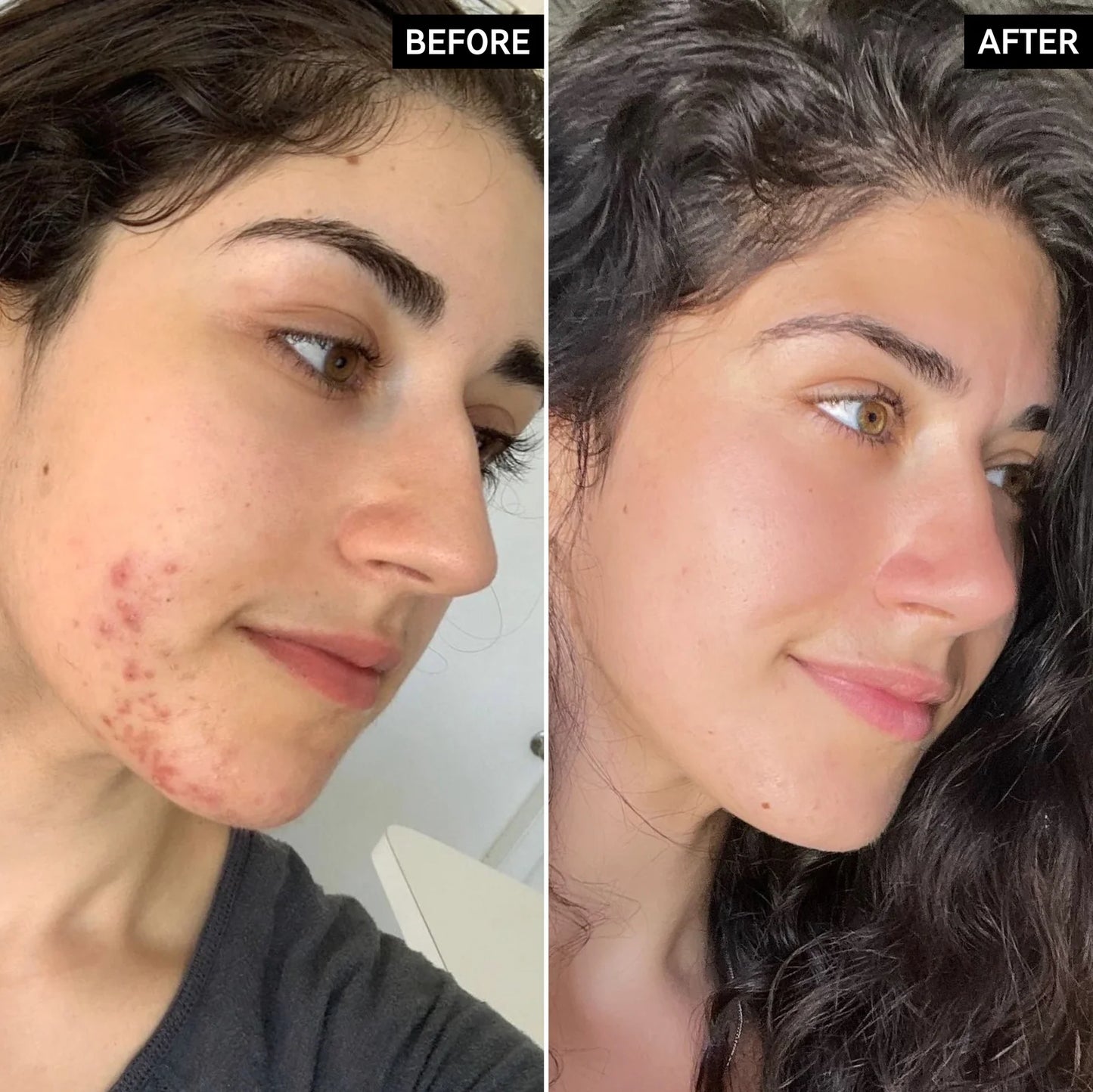LISTA E BJESËVE Trajtim i njollave me acid succinic 15ml