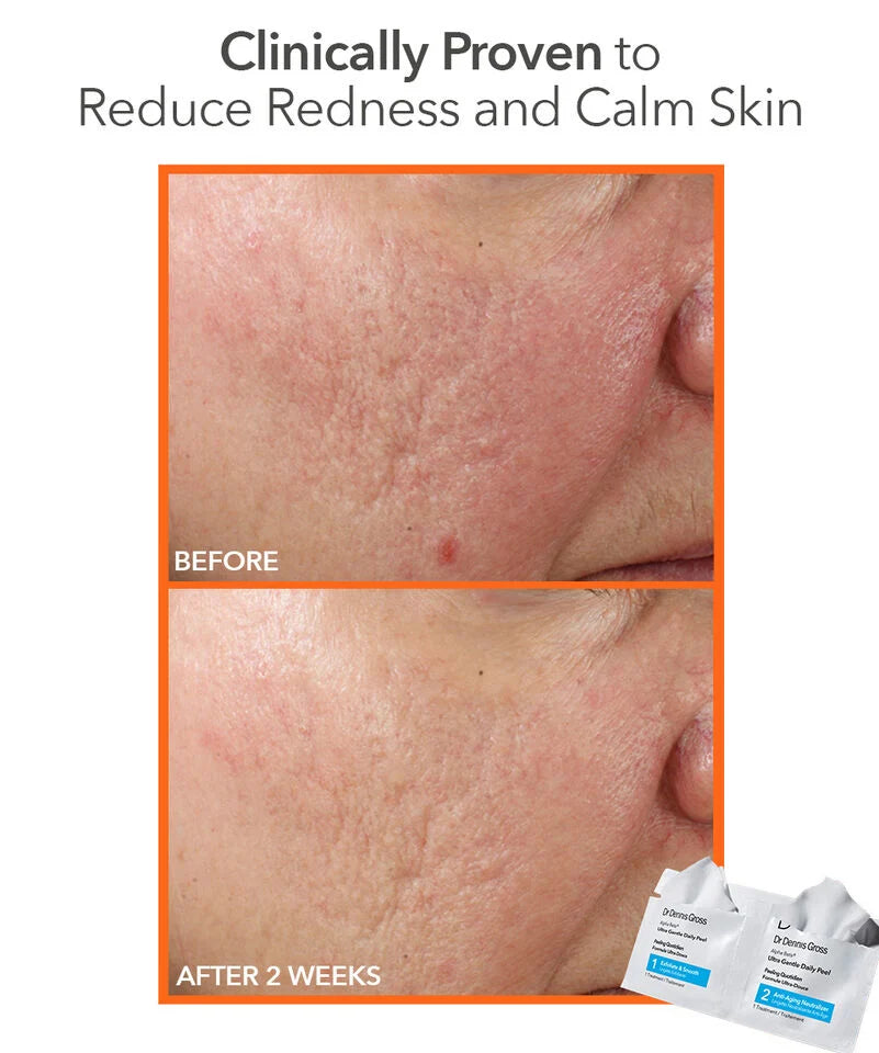 Dr Dennis Gross Alpha Beta Ultra Gentle Daily Peel
