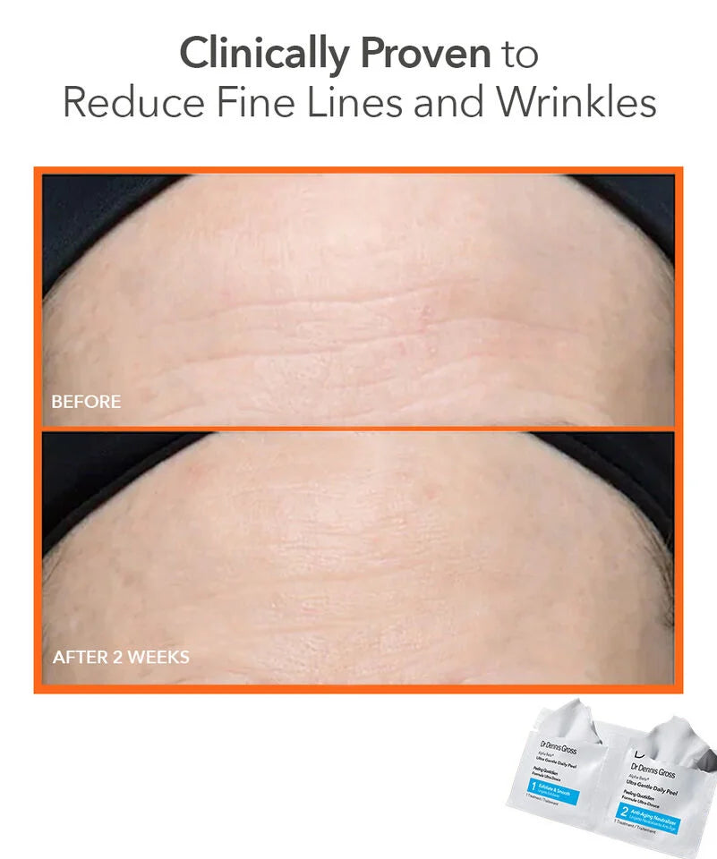 Dr Dennis Gross Alpha Beta Ultra Gentle Daily Peel