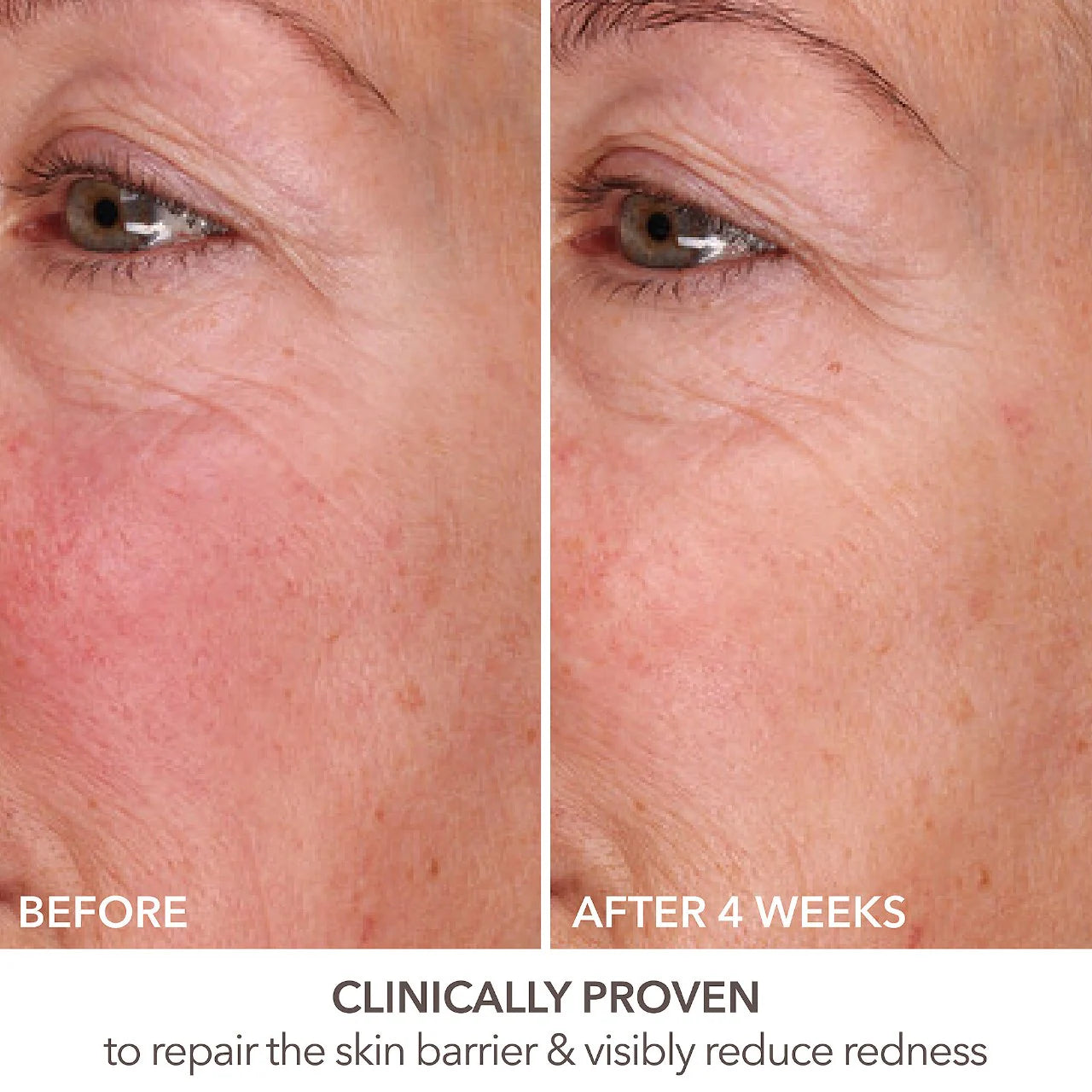 DR DENNIS GROSS DermInfusions Fill + Repair Serum with Hyaluronic Acid