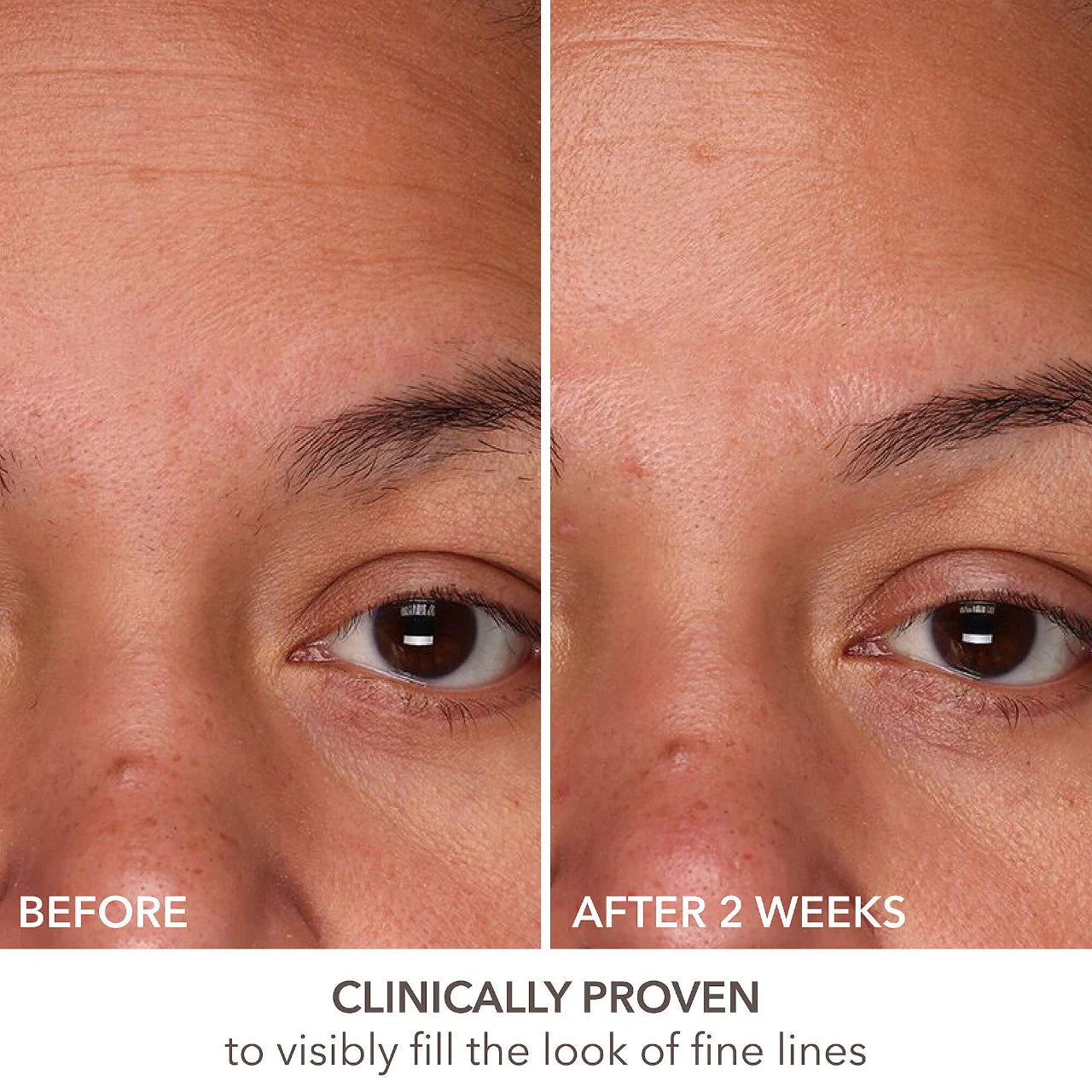 DR DENNIS GROSS DermInfusions Fill + Repair Serum with Hyaluronic Acid