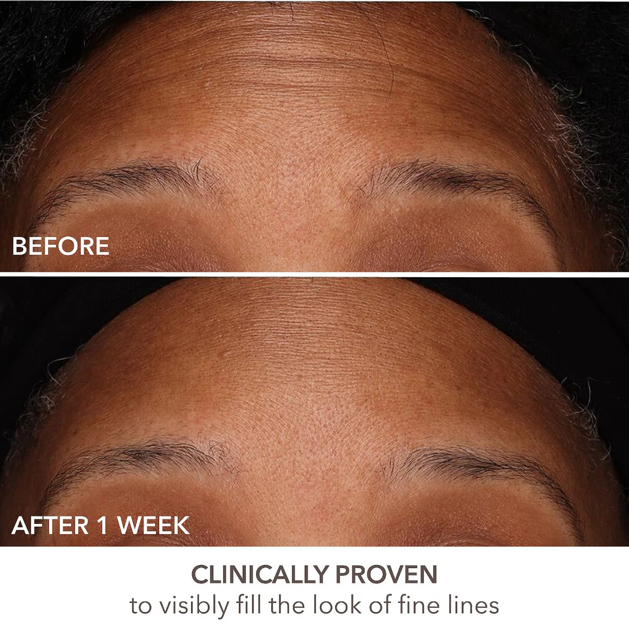 DR DENNIS GROSS DermInfusions Fill + Repair Serum with Hyaluronic Acid